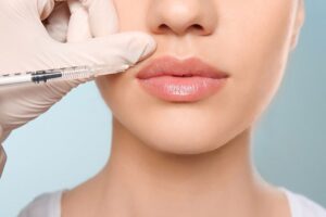 everything you need to know about dermal fillers
